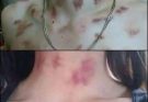 1-TG If your partner makes you these chu…